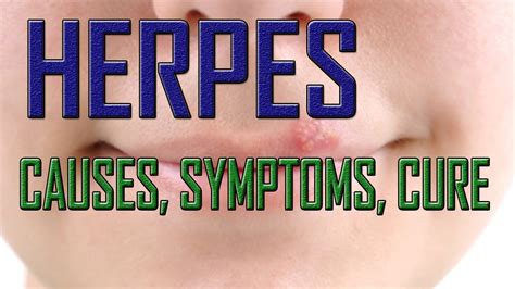 what causes herpes in adults